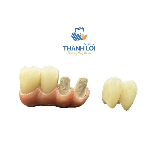 Cầu Phục hình bắt vis từ đơn lẻ đến 2-3 đơn vị trên Multi (Ko cần Cylinder) - Ảnh 4